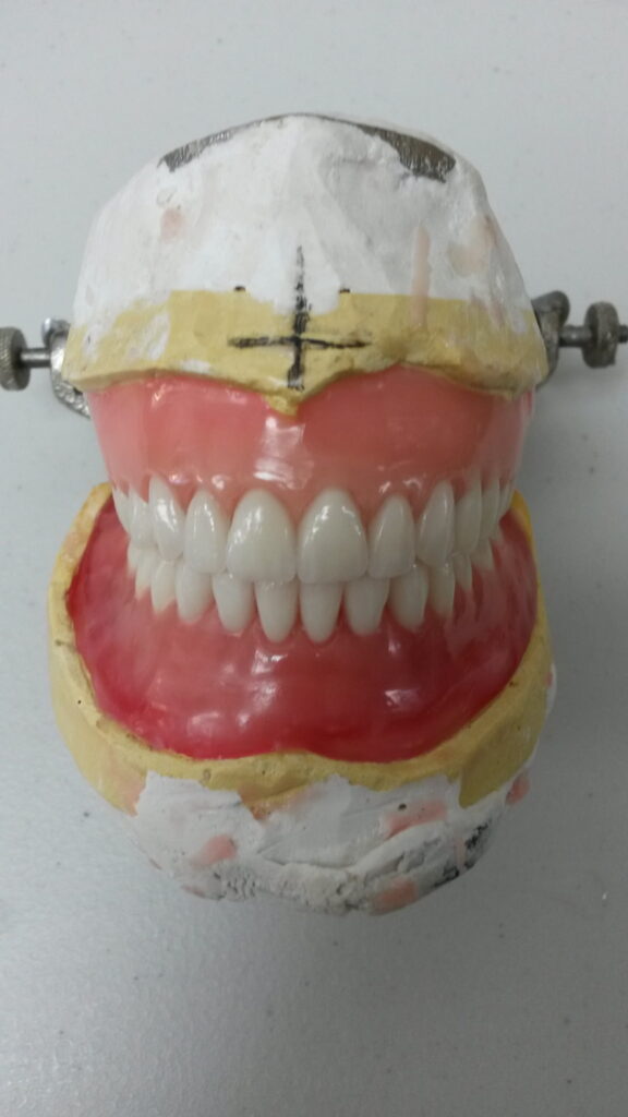 dentures